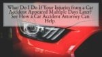 What Do I Do If Your Injuries from a Car Accident Appeared Multiple Days Later See How a Car Accident Attorney Can Help.